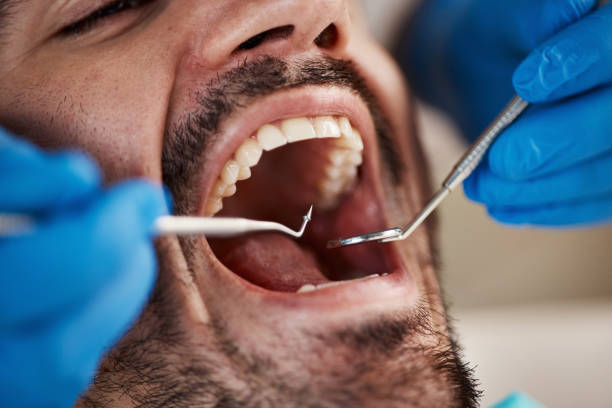 Best Emergency Gum Treatment in Weldon, NC