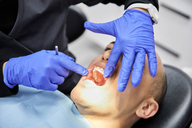 Best Emergency Treatment for Dental Infections or Abscesses in Weldon, NC